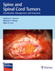 Book cover of: Spine and Spinal Cord Tumors. By: Andrew Fanous