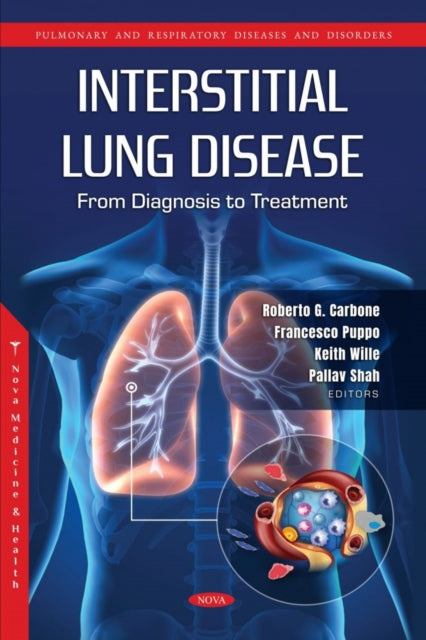Book cover of: Interstitial Lung Disease: From Diagnosis to Treatment. By: Roberto G. Carbone