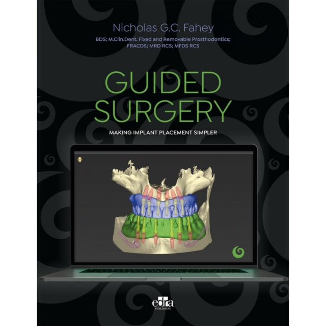 Book cover of: Guided Surgery. By: Nicholas G.C. Fahey