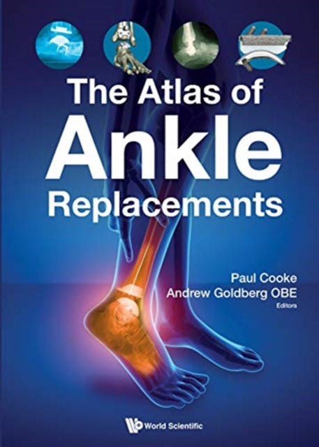 Book cover of: Atlas of Ankle Replacements. By: Andrew Goldberg