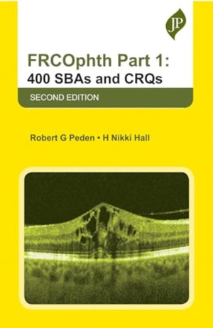 FRCOphth Part 1: 400 SBAs and CRQs