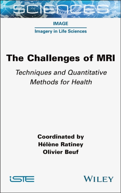 Book cover of: Challenges of MRI. By: Olivier Beuf
