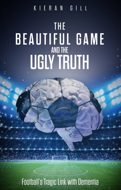Book cover of: Beautiful Game and the Ugly Truth. By: Kieran Gill