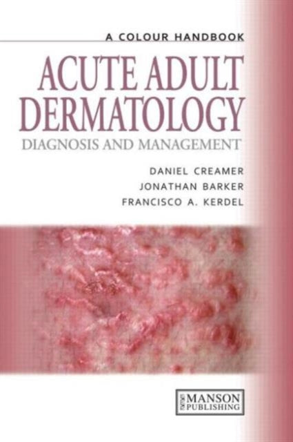 Book cover of: Acute Adult Dermatology
