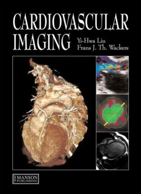Book cover of: Cardiovascular Imaging. By: Yi-Hwa Liu