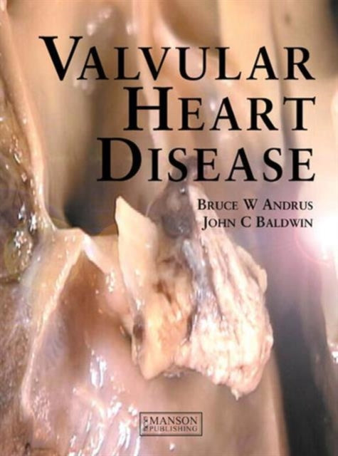 Book cover of: Valvular Heart Disease. By: Bruce W Andrus