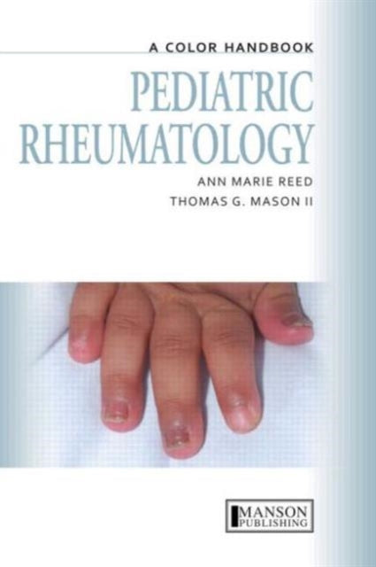 Book cover of: Pediatric Rheumatology. By: Ann Marie Reed