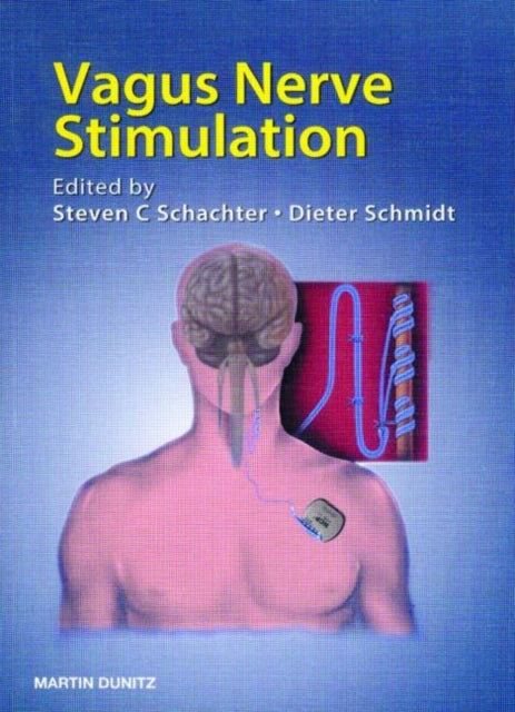 Book cover of: Vagus Nerve Stimulation
