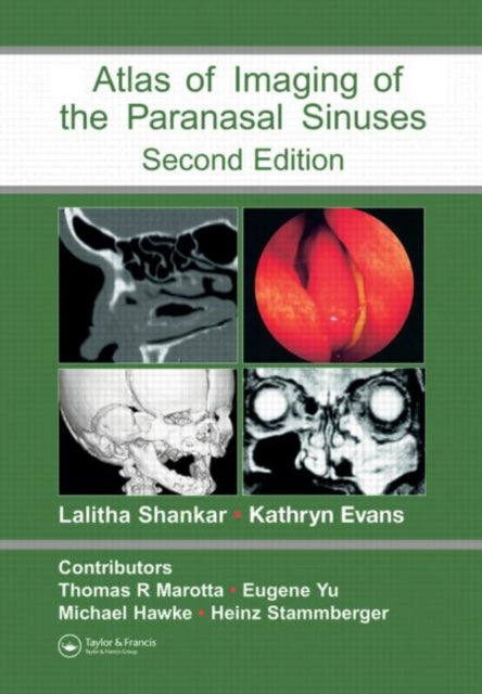 Book cover of: Atlas of Imaging of the Paranasal Sinuses, Second Edition