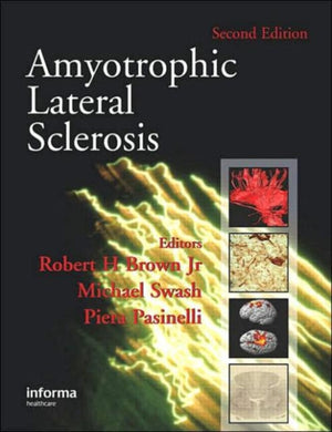 Amyotrophic Lateral Sclerosis, Second Edition