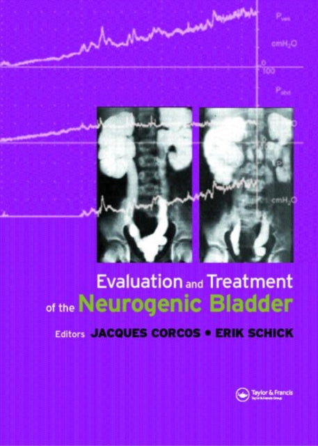 Book cover of: Evaluation and Treatment of the Neurogenic Bladder