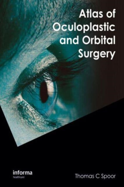 Book cover of: Atlas of Oculoplastic and Orbital Surgery. By: Thomas C. Spoor