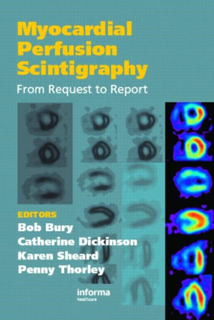 Book cover of: Myocardial Perfusion Scintigraphy. By: Bob Bury
