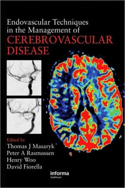 Book cover of: Endovascular Techniques in the Management of Cerebrovascular Disease