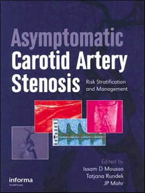 Book cover of: Asymptomatic Carotid Artery Stenosis