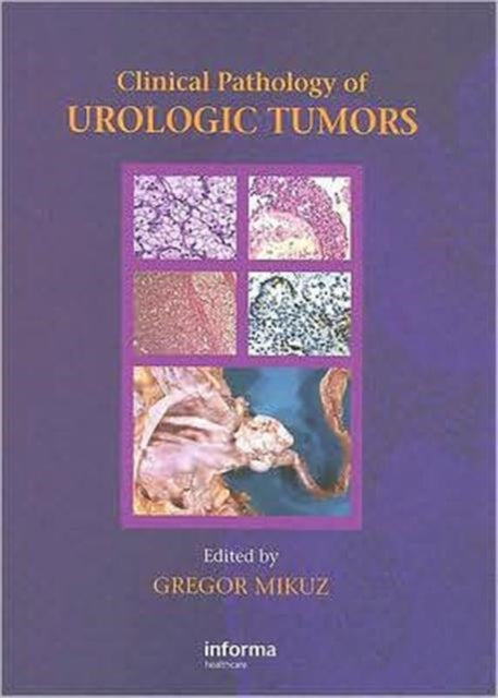Book cover of: Clinical Pathology of Urological Tumours. By: Gregor Mikuz