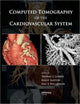 Book cover of: Computed Tomography of the Cardiovascular System