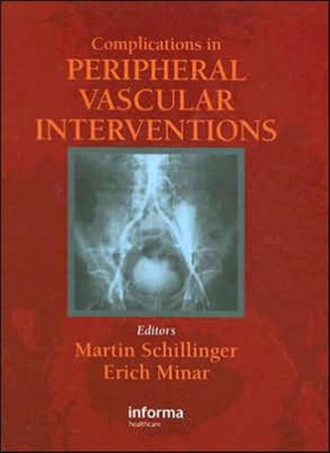 Book cover of: Complicatons in Peripheral Vascular Interventions