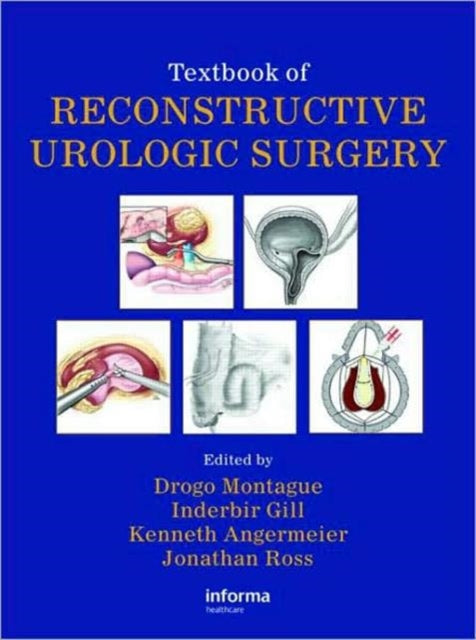 Textbook of Reconstructive Urologic Surgery