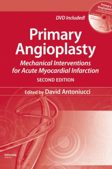 Book cover of: Primary Angioplasty