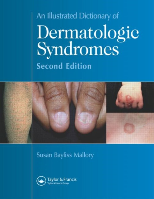 Book cover of: Illustrated Dictionary of Dermatologic Syndromes. By: Susan B. Mallory