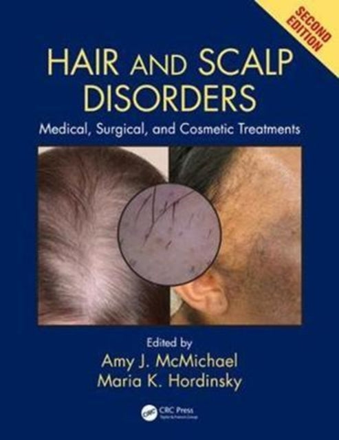 Book cover of: Hair and Scalp Disorders. By: Amy J. McMichael