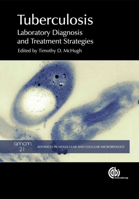 Book cover of: Tuberculosis. By: Timothy D. McHugh
