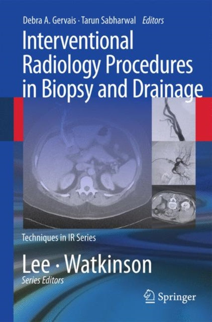 Book cover of: Interventional Radiology Procedures in Biopsy and Drainage. By: Debra Gervais