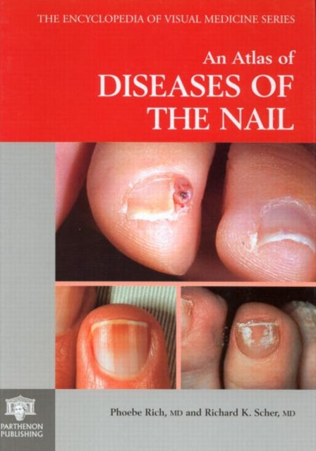Book cover of: Atlas of Diseases of the Nail