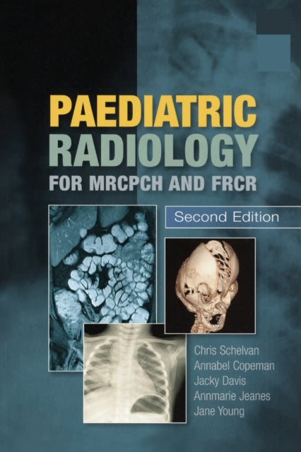 Book cover of: Paediatric Radiology for MRCPCH and FRCR, Second Edition. By: Christopher Schelvan