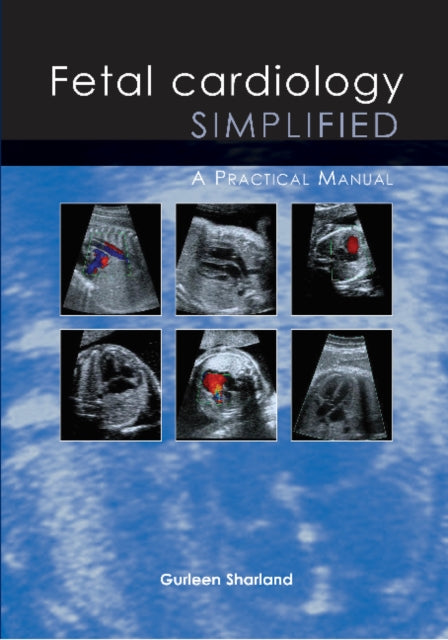 Book cover of: Fetal Cardiology Simplified. By: Gurleen Sharland