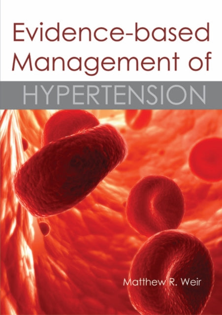 Book cover of: Evidence-based Management of Hypertension