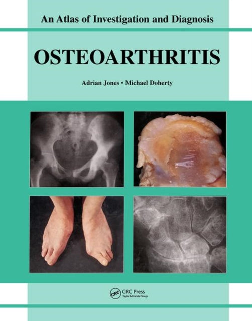 Book cover of: Oesteoarthritis. By: Adrian Jones