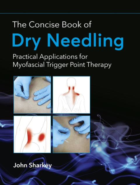 The Concise Book of Dry Needling