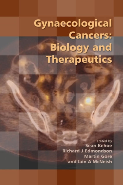 Book cover of: Gynaecological Cancers. By: Sean Kehoe