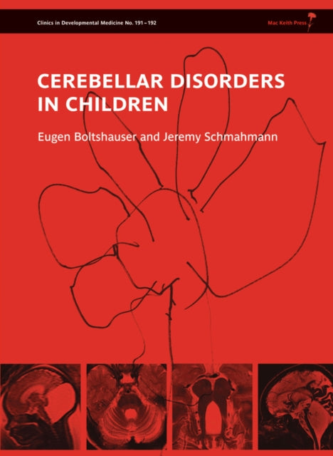 Book cover of: Cerebellar Disorders in Children