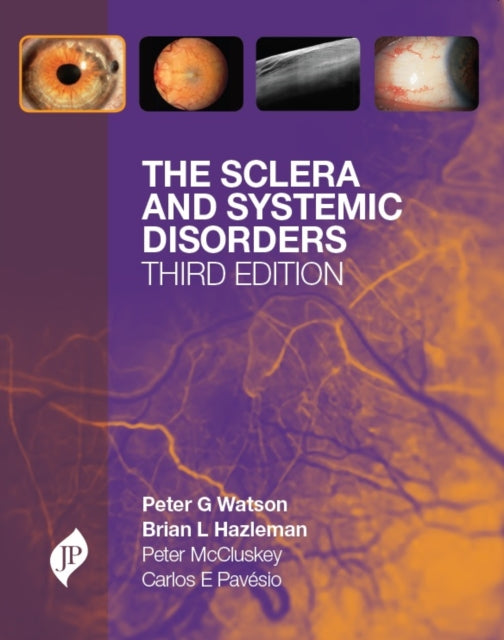 Book cover of: Sclera and Systemic Disorders