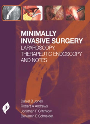 Minimally Invasive Surgery