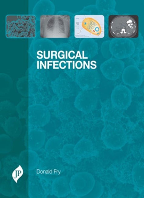 Book cover of: Surgical Infections. By: Donald Fry