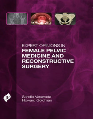 Expert Opinions in Female Pelvic Medicine and Reconstructive Surgery