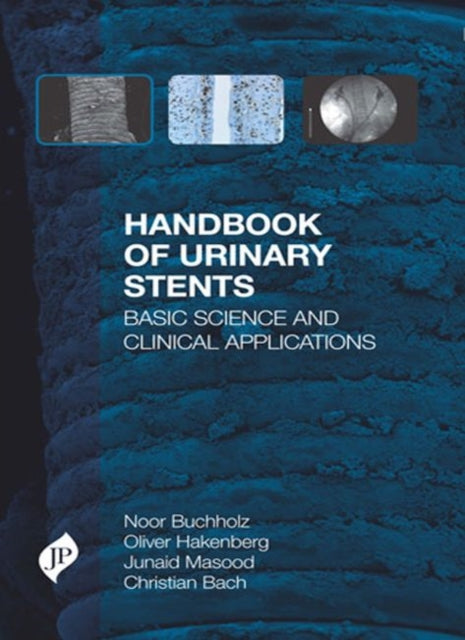 Book cover of: Handbook of Urinary Stents. By: Noor Buchholz