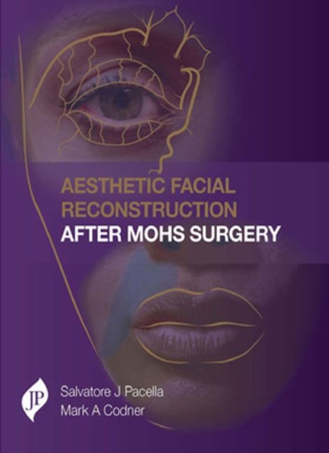 Book cover of: Aesthetic Facial Reconstruction After Mohs Surgery. By: Salvatore Pacella