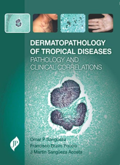 Book cover of: Dermatopathology of Tropical Diseases. By: Omar P. Sangüeza