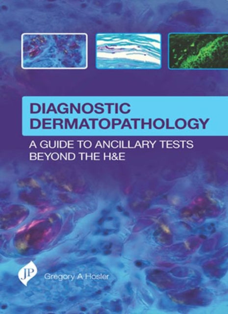 Book cover of: Diagnostic Dermatopathology: A Guide to Ancillary Tests Beyond the H&E. By: Gregory A. Hosler