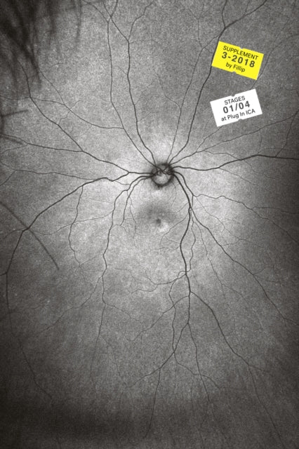 Book cover of: Supplement 3: The Invention and Conclusion of the Eye