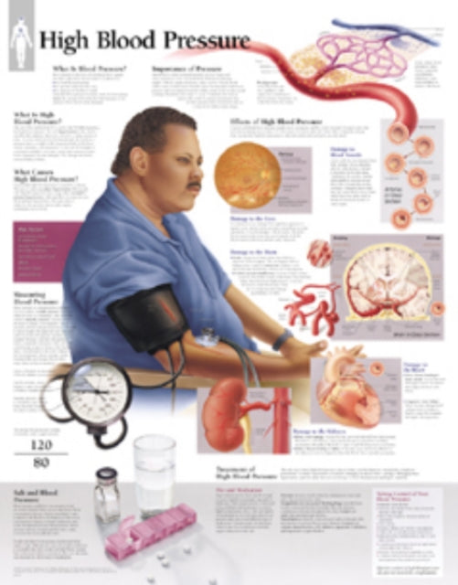 Book cover of: High Blood Pressure Laminated Poster. By: Scientific Publishing