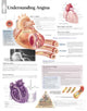 Book cover of: Understanding Angina Paper Poster. By: Scientific Publishing