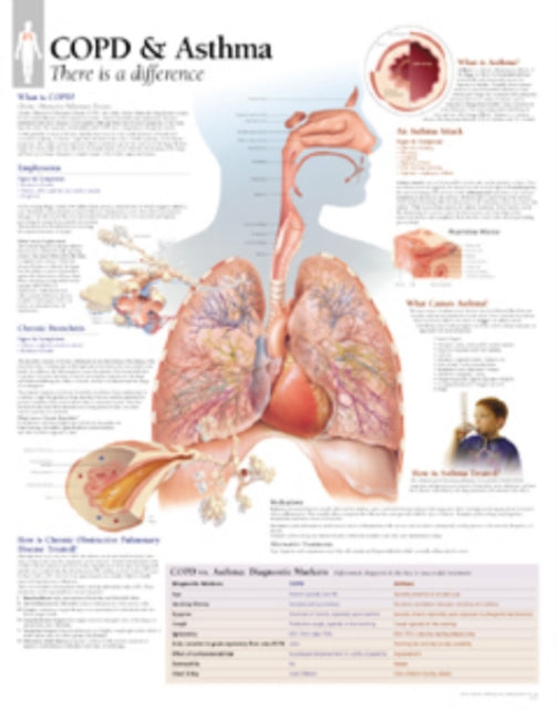Book cover of: COPD & Asthma Laminated Poster. By: Scientific Publishing