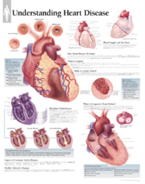 Book cover of: Understanding Heart Disease Laminated Poster. By: Scientific Publishing