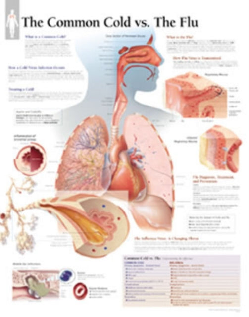 Book cover of: Common Cold vs the Flu Paper Poster. By: Scientific Publishing